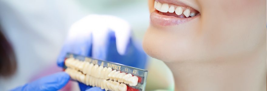 Comment avoir recours à l&rsquo;implant dentaire ?