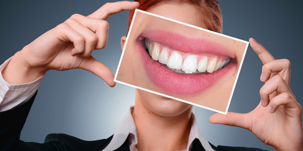 Quels sont les avantages d’une colle dentaire ?